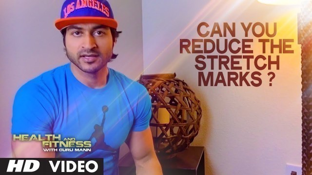 'Can you reduce the Stretch Marks? | Health and Fitness Tips | Guru Mann'