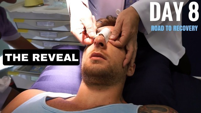 'The Reveal| Nose Surgery Day 8 Ep.5| Jackson Johnson Fitness| Rhinoplasty'