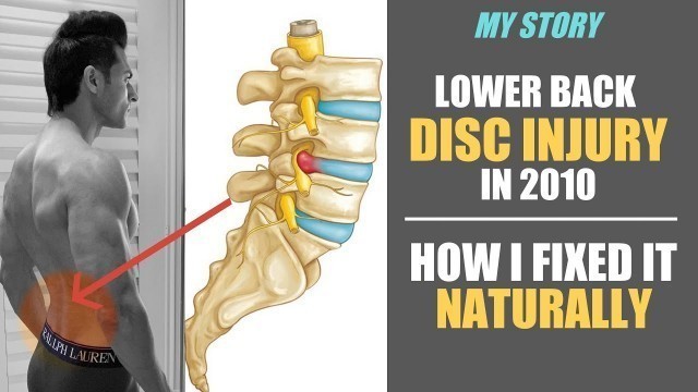 'My Lower Back Disc Injury in 2010 - How I Fixed it NATURALLY (Guru Mann)'