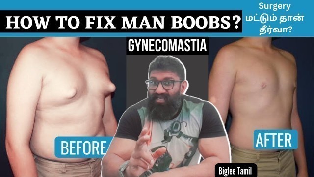 'Gynecomastia - How to fix man boobs | Biglee Tamil'