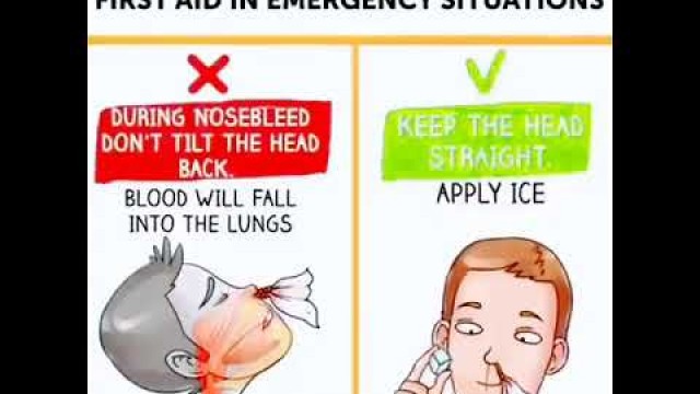 'first Aid in Emergency situations   #short #shorts  @healthfithindi #fitness @weightloss'