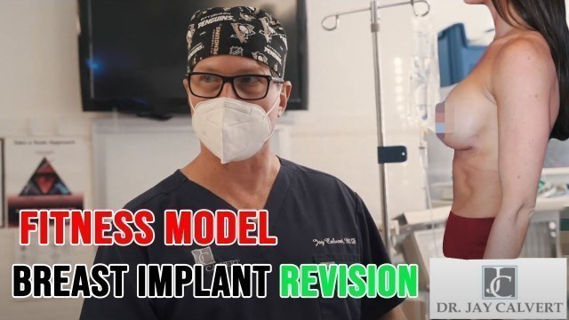 'Fitness Model Breast Implant Revision - Fitness Model FULL Breast Augmentation Revision Experience'