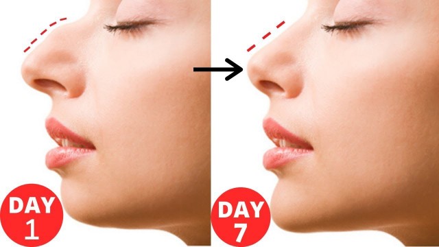 'How To Get Straight , Slim and Sharper Nose/ Beauty Tips In Hindi'