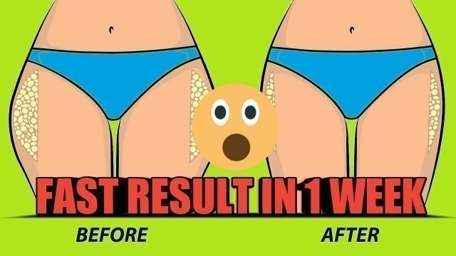 'LOSE THIGH FAT IN 1 MINUTE || 3 SIMPLE EXERCISE OF SLIM LEGS|| REPEAT DAILY'