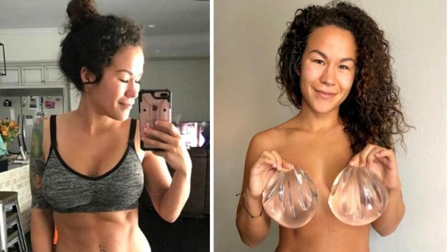 'Why Fitness Influencer Chose to Remove Breast Implants'